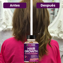 Detén la Caída y Activa el Crecimiento desde la Raíz – Hair Growth Advanced imagen 5